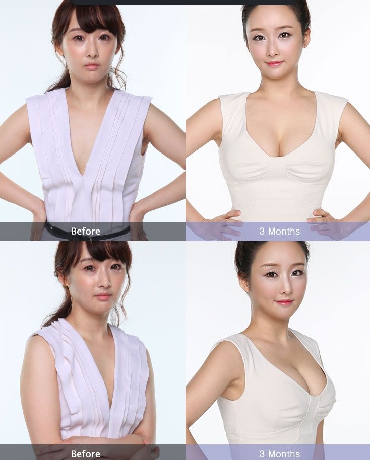 1757476130333878.jpg 1755148382151499.jpg